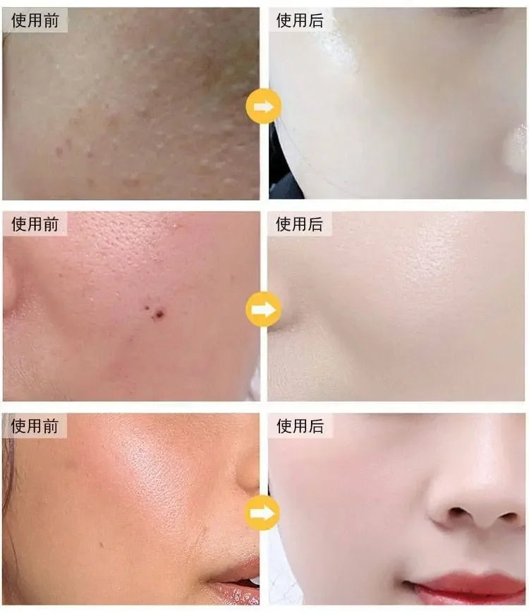 100ml 24k Gold Hyaluronic Acid Nicotinamide Face Serum Anti Aging Facial Lifting Collagen Essence Skin Care Whitening Serum