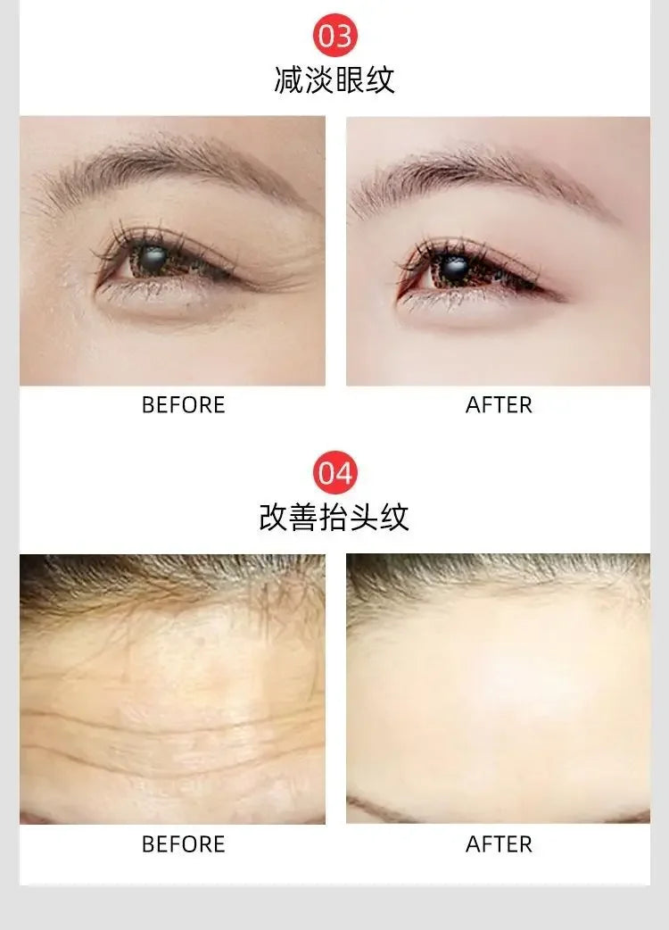 100ml 24k Gold Hyaluronic Acid Nicotinamide Face Serum Anti Aging Facial Lifting Collagen Essence Skin Care Whitening Serum
